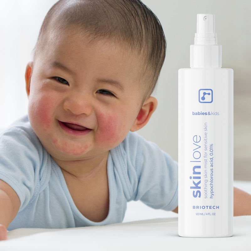 [Australia] - Briotech Baby Skin Love Spray | Gentle Hypochlorous Acid Mist for Soothing, Calming & Cleansing Delicate Skin | Pediatrician-Approved, Added Fragrance-Free | 4 oz (4 Pack) 4 Fl Oz (Pack of 4) 