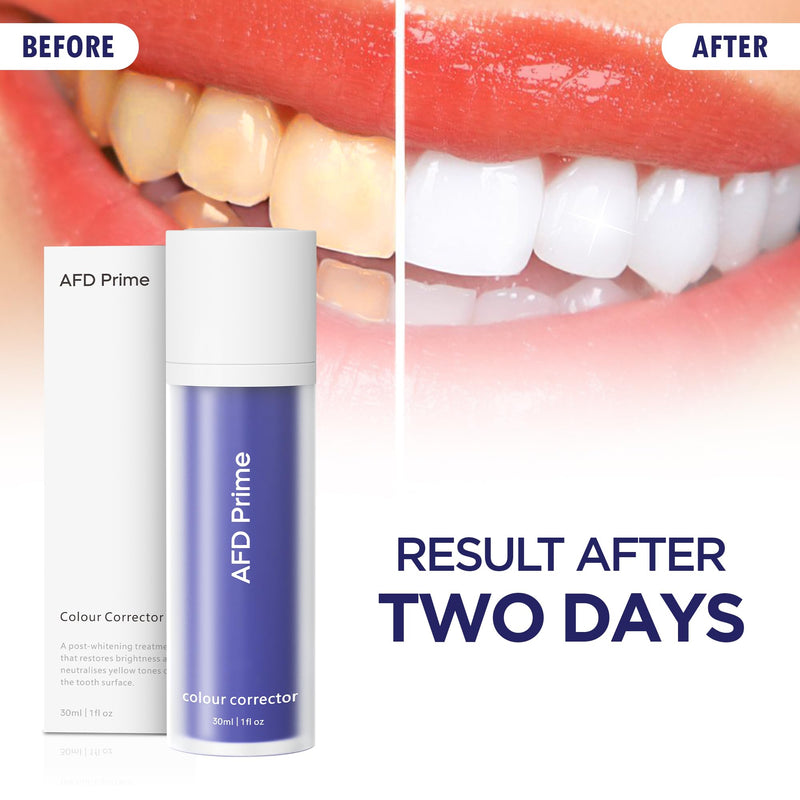 [Australia] - Purple Toothpaste, Teeth Stain Concealer, Teeth Whitening Booster for Yellow & Sensitive Teeth, Purple Luxe Toothpaste for Adults 