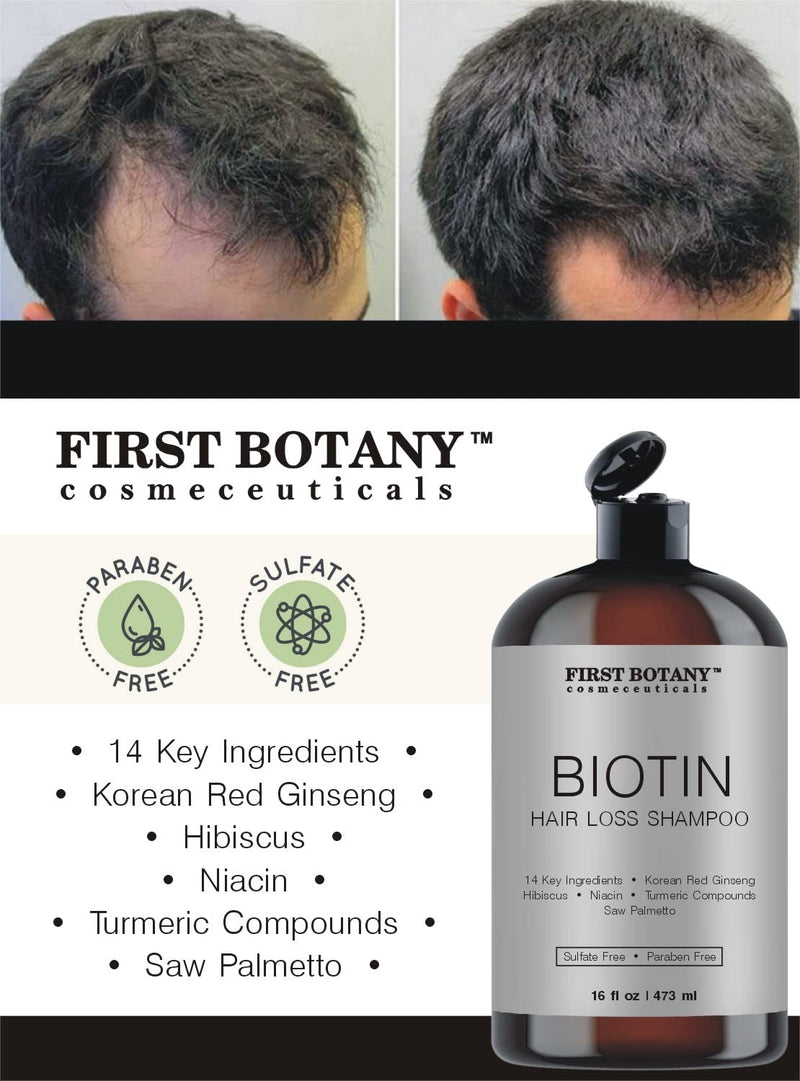 Hair Regrowth & Anti-Hair Loss Shampoo with DHT Blockers, 16 fl oz 16 Fl Oz (Pack of 1)