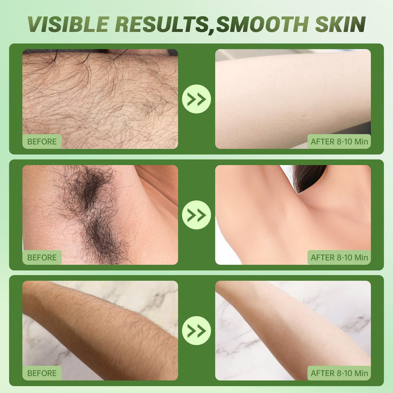 [Australia] - Hair Removal Cream For Women - Painless Body Hair Remover Sensitive Skin Hair Removal For Back Legs Fast And Gentle 6.76 Fl Oz 6.76 Fl Oz (Pack of 1) 