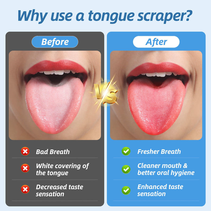 [Australia] - 6 Pack Tongue Scraper - Reusable & Easy to Clean Tongue Scrubber with Travel Case for Adults & Kids - Medical-Grade 100% Stainless Steel Tongue Cleaner for Fresh Breath & Oral Care Silver 6 Pack 