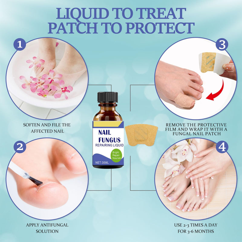 At-Home Intensive Fungal Nail Treatment Kit – 30mL Solution + 32 Renewal Patches, Targets Thickened, Yellowed, Damaged Nails, Precision Applicator for Easy Use on Toenails & Fingernails