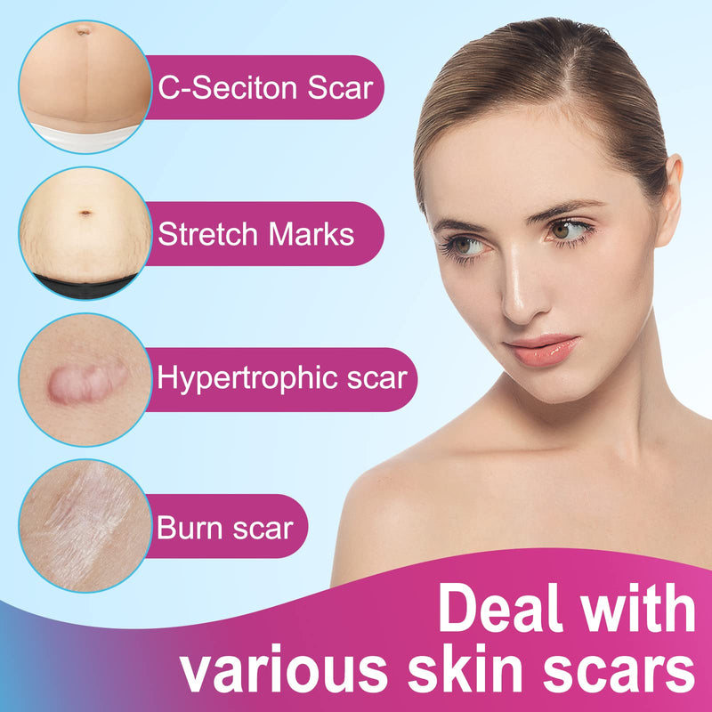 [Australia] - Silicone Scar Sheets,Silicone Scar Tape Roll,Soft Silicone Tape for Scar Removal,Reusable Waterproof Professional Scar Treatment Patch for C-Section,Keloids,Surgical,Acne (Roll Size 1.6''x75''-1.9M) Roll Size 1.6''x75'' 