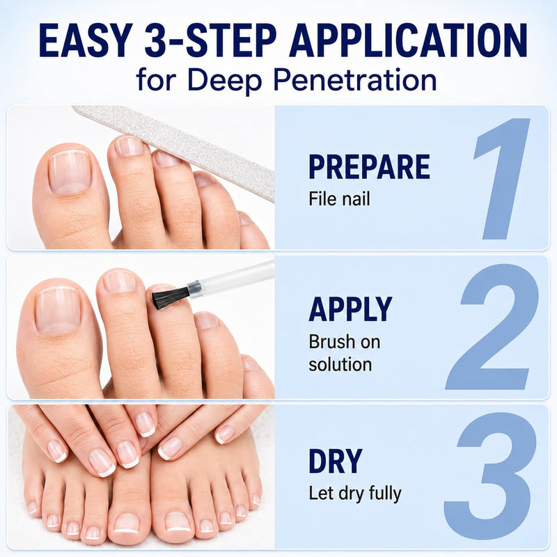 Nail Renewal Treatment Extra Strength: 25% Undecylenic Acid OTC Formula – Toenail Nail Care Kit with Brush & File for Ingrown Nails, Discoloration & Brittle Nails, Thick-Looking, Rough-Looking