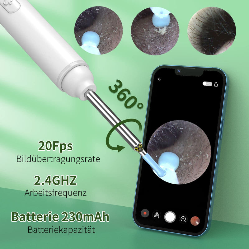[Australia] - Earwax Remover Otoscope, VITCOCO 1920P Wifi Ear Cleaner, Ear Cleaner with Camera, Otoscope with 6 LEDs for iPhone, iPad and Android Smartphones, White 