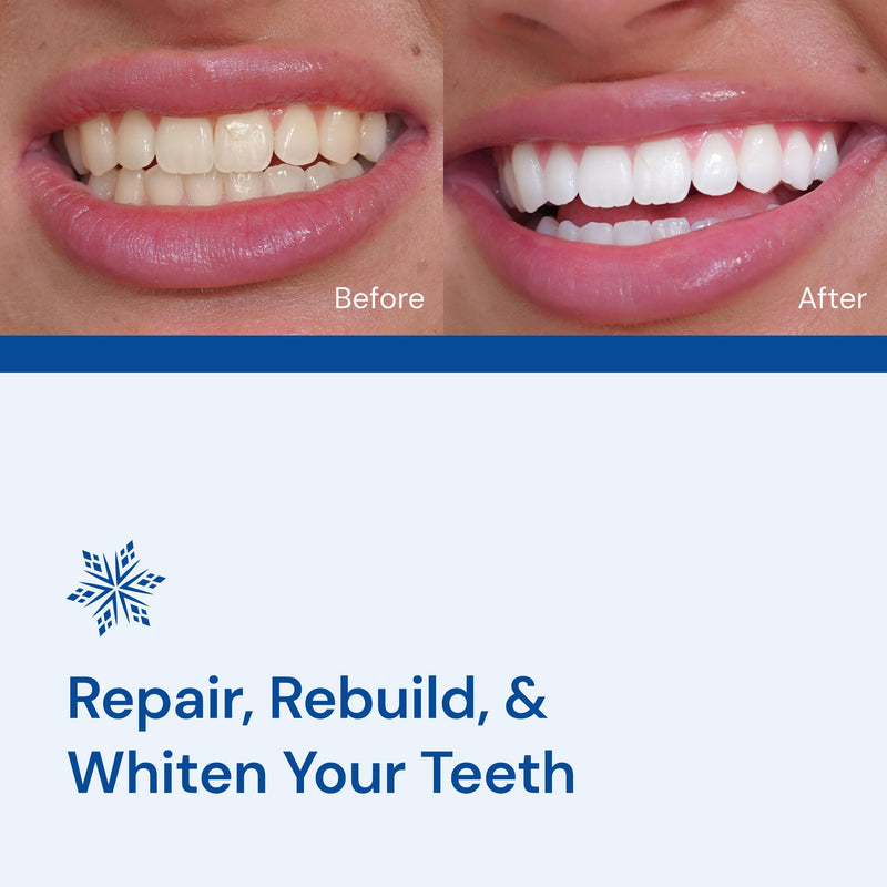[Australia] - Snow Teeth Whitening Kit - Snow Teeth Whitening Serum and LED Mouthpiece Whitener, Formulated with Hydroxyapatite, Good for 2 Months - Wired Kit with 1 Wand Diamond Wired - 1 Wand 