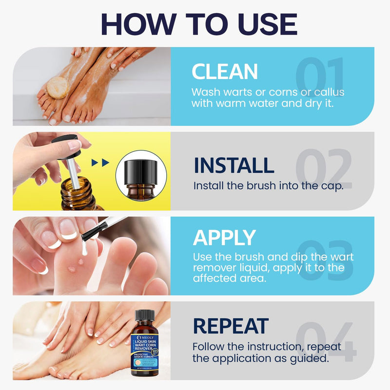 [Australia] - Fast-Acting Wart Remover: 40% Salicylic Acid Wart Remover Maximum Strength for Plantar Wart, Corn Men and Women 