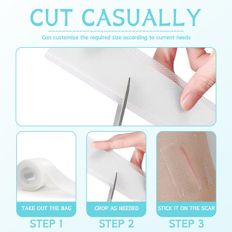 [Australia] - Volhuluk Transparent Silicone Scar Plaster (4x150cm), Silicone Plaster Professional for C-Section Scars, Operations, Burns, Keloid, Acne and More, Silicone Plaster for Scars 
