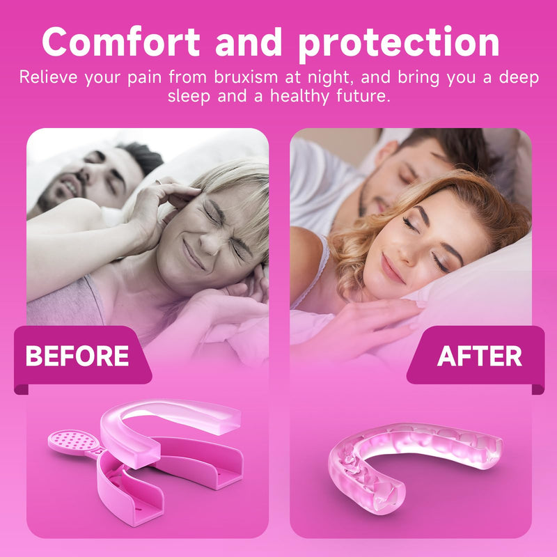 Upgraded Mouth Guards for Grinding Teeth, 4 Pack, Standard Size, Professional Night Guard with Fitting Tray, Comfortable Mouth Guard for Clenching Teeth Pink