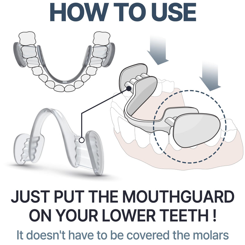 [Australia] - Mouth Guard for Grinding and Clenching Teeth at Night, Sleep Night Guard, Grinding Protection, Clenching Protection, Teeth Bruxism Mouth Piece with Travel Hygiene Case (2set) (1set) 1set 