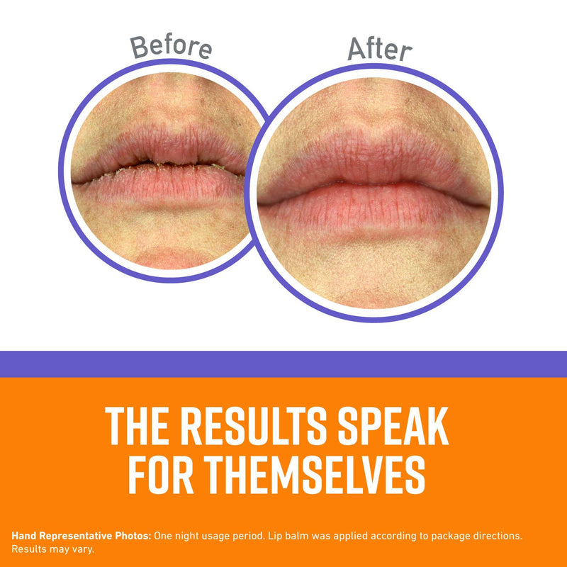 [Australia] - O'Keeffe's Lip Repair Night Treatment Lip Balm, 0.25 Ounce Jar, (Pack of 1) 0.25 Ounce (Pack of 1) 