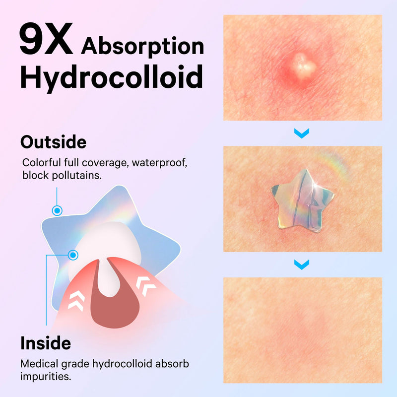 Sosky Hologram Pimple Patches for Face, Hydrocolloid Acne Patches with Salicylic Acid, Cute Star Zit Stickers,Colorful Blemish Covers,72 Count Blue Pink Star Heart Moon Cloud Butterfly Flower