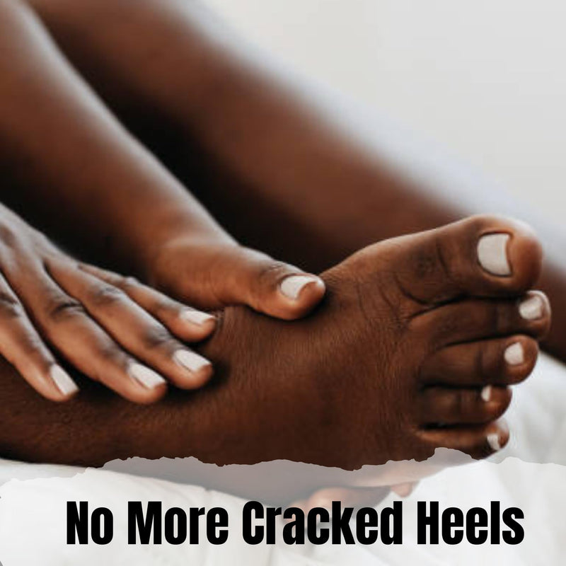[Australia] - Harper's Naturals Hand and Foot Cream, Moisturizing, Softens, For Dry, Cracked Hands and Feet - 2 oz 