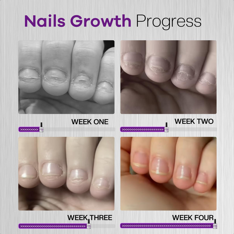 Glamonade Stop Nail Biting Polish Extra Strength Formula Upgraded Bitterness Effective Anti-Biting Treatment for Adults Kids Bitter Nail Deterrent to End Thumb Sucking Water Resistant & Long Lasting 0.5 Count (Pack of 1)