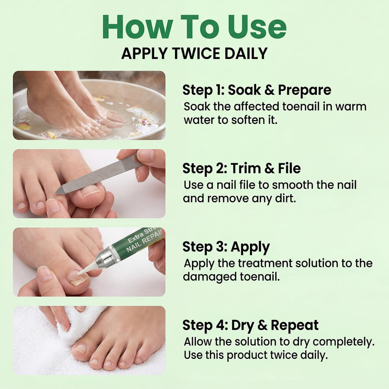 High capacity Nail Pen-16 ml per unit,Toenail Pen Treatment