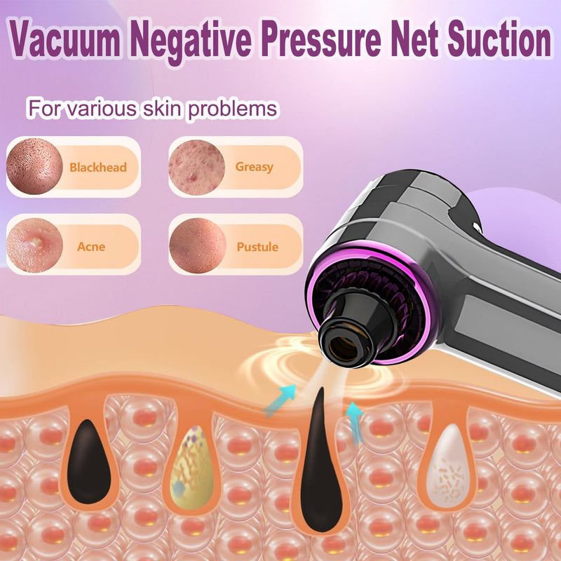Blackhead Remover Pore Vacuum with Hot Compress, Upgraded Facial Pore Cleaner, Pore Extractor Acne White Heads Removal Tool- 9 Suction Power, 5 Probes Blackhead Vacuum Kit for Women & Men 1 Count (Pack of 1)