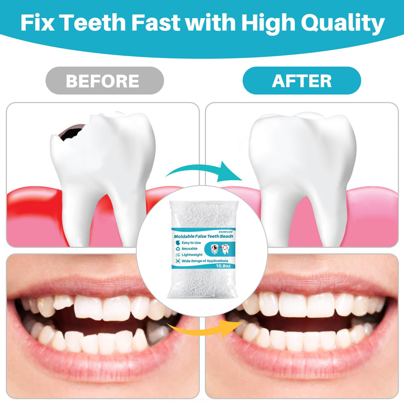 [Australia] - 10.9oz Thermoplastic Teeth Repair Beads - Moldable False Teeth Beads,Tooth Repair kit for DIY Tooth Filling,Plastic Pellets Replacement,for Halloween Vampire Teeth Fangs 