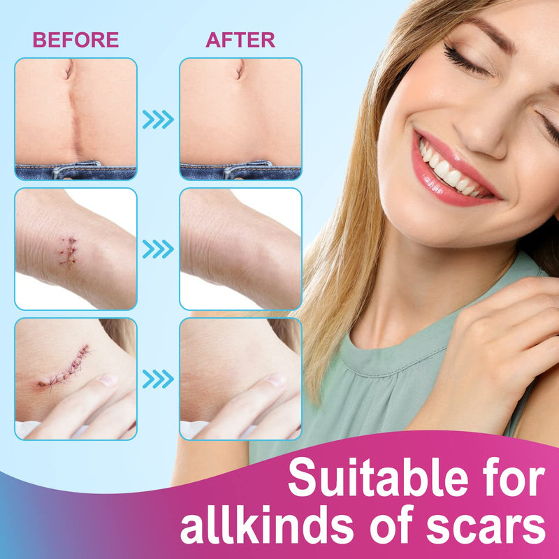 [Australia] - silicone scar tape, silicone plaster for scars, silicone scar sheets, silicone scar cloths (1.6" x 75")-1.9M, silicone scar sheets, professional for scars through C section, silicone scar plaster 1 pack 1.6" 