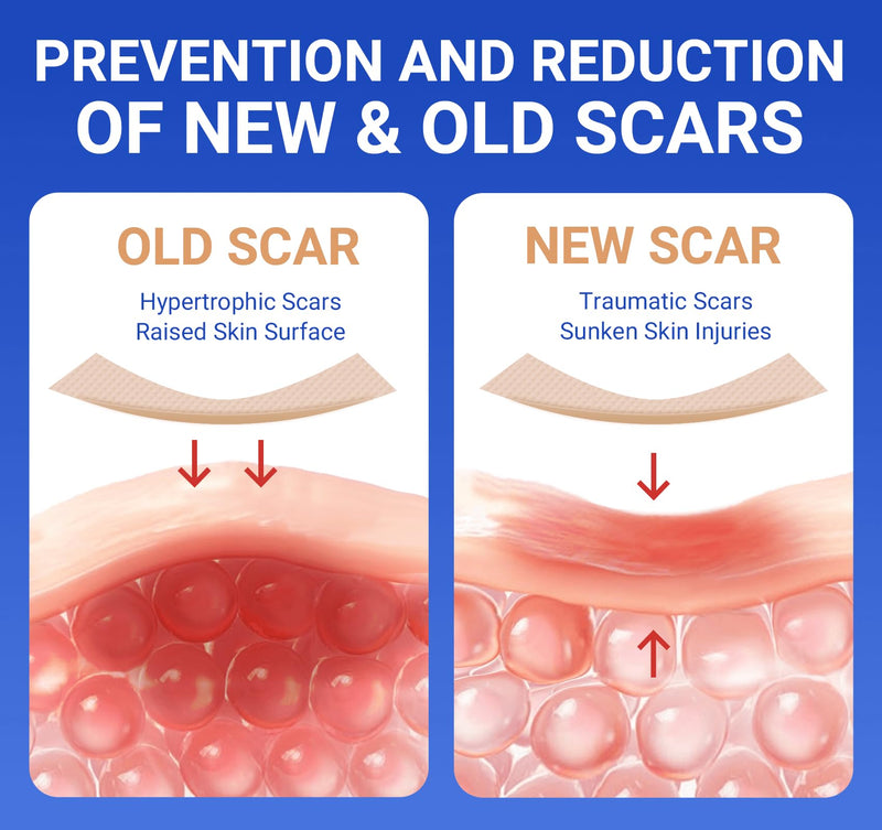 [Australia] - Silicone Scar Sheets Medical Grade Tape (1.6"x60" Roll), Healing Patches for C-Section, Keloid, Face Wrinkles, Stretch Marks, Surgical Recovery, Professional Scar Cover for Sensitive Skin, Soft Tissue 1.6"X60‚Äú 