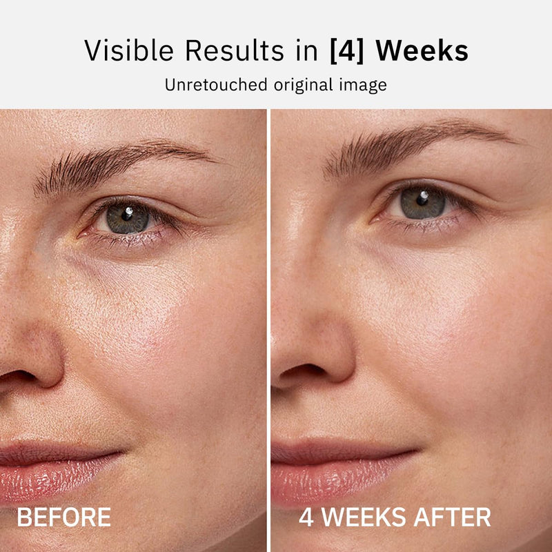 HKH Vitamin C Serum Capsules For Face: 48 Caps Anti-Aging Wrinkles With Vit C & Vitamin E Serum For Women Over 30+ - Reducing Fine Lines - Smoothing & Firming Skin - Travel-Friendly (Vitamin C)