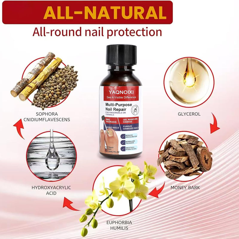 Toenail Fungus Treatment - Fast Acting For Thick, Discolored, Broken & Damaged Toe & Finger Nail, Treats Damaged Nails and Ingrown Toenails - 30ml/1oz (2pcs) 2pcs