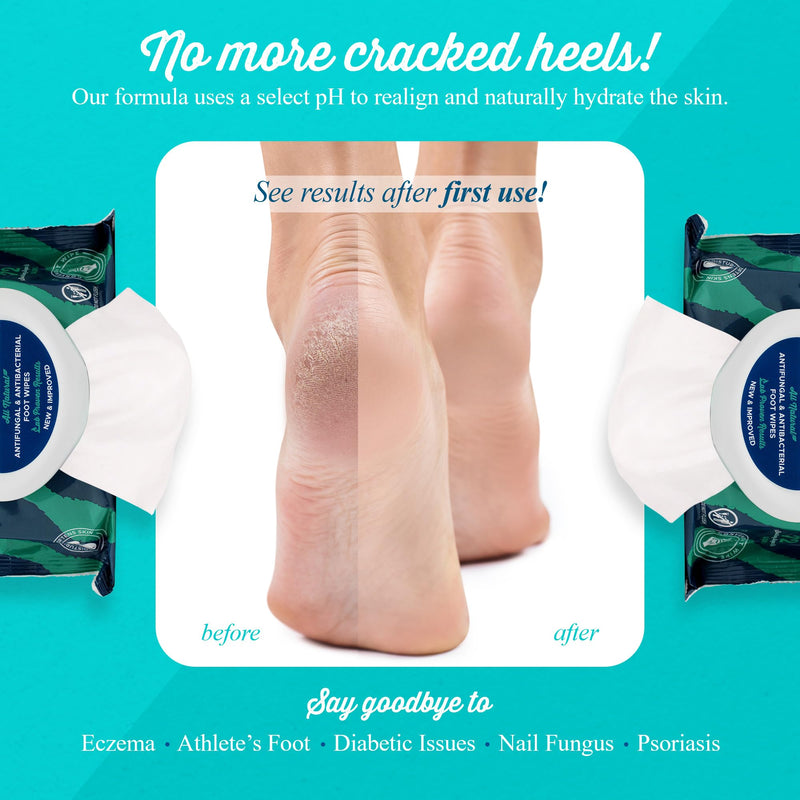 pHeet® Foot Wipes All-Natural Antifungal & Antibacterial Formula 72ct | Cleanses, Moisturizes, Prevents & Kills Athlete's Foot, Toenail & Foot Fungus, Odor & Improves Dry, Cracked, Flaky Skin