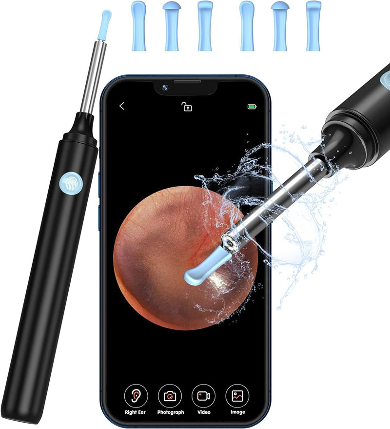 [Australia] - VITCOCO Ear Wax Removal Kit Ear Camera, 1920P Ear Cleaner Ear Wax Remover, 3.9mm Waterproof Ear Endoscope Camera Earwax Cleaning Tool for iPhone, Ipad & Android Smart Phones black 