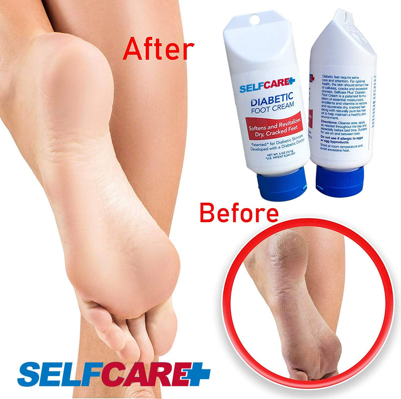 [Australia] - Diabetic Foot Cream For Dry Cracked Feet. Leaves Hands Legs, Feet & Body Smooth Patented Lotion, 5 oz 