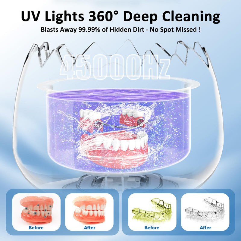 [Australia] - Ultrasonic Retainer Cleaner Machine for Denture, Dental Cleaning Pod with Digital Timer, 45kHz/180ML Waterproof Ultrasonic Denture Cleaners for Aligner, Mouth Guard, Braces, Ring Jewelry Cleaner White 