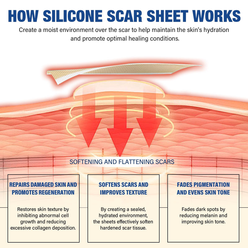 [Australia] - Silicone Scar Sheets,Silicone Scar Tape(1.6"x 158" Roll-4 meters),Silicone Scar Sheets for Surgical Scars,Keloid Bump Removal,Scar Tape for Surgical,C-Section,Tummy Tuck,Keloid Scars 