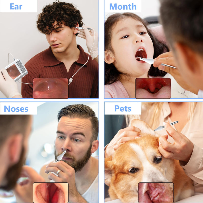 [Australia] - Earwax Remover Otoscope, VITCOCO 3.9mm Otoscope with 4.3 Inch HD IPS Screen, Ultra Thin Ear Cleaner, Ear Cleaner with Camera, White 