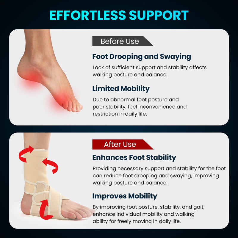 Welnove Drop Foot Brace with Arch Support, AFO Ankle Brace for Walking, Relieves Instability of Lower Limbs by Foot Drop, MS, TBI, Spinal Cord Injury, Cerebral Palsy (Right, Beige)