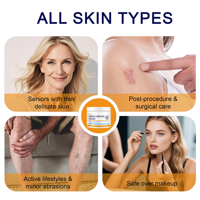 Arnica Montana Cream with Vitamin K,4.23 OZ | Daily Hydrating Moisturizer for Seniors & Thin Skin, Soothe Bruising Swelling Discoloration on Face and Body 1
