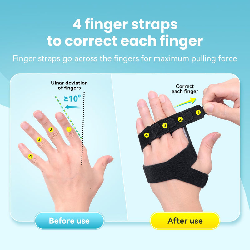 [Australia] - DrFinger Finger Ulnar Deviation Splint Brace, Finger Joint Deviation Orthopedic Corrector With Metal Bracket-Black-(Right-M) Black Right-M 
