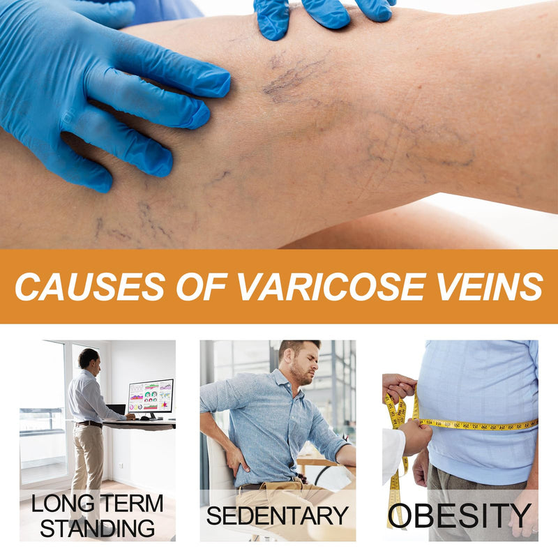 [Australia] - Grgowe varicose veins cream + vein repair spray, varicose veins cream, cream against spider veins, veins active, spider veins, relieves leg pain and swelling 