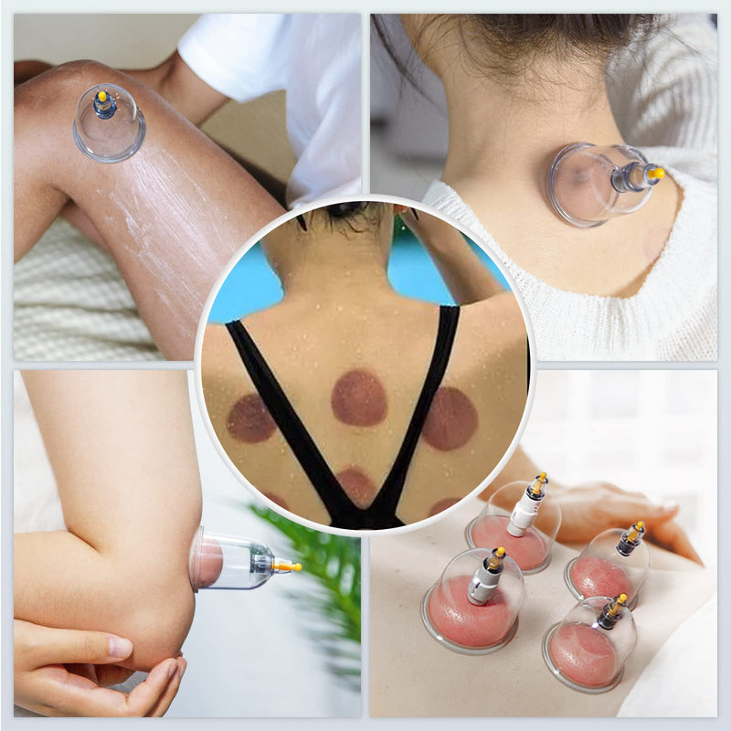 [Australia] - KingPavonini 24 Cups Cupping Therapy Set, Professional Chinese Cupping Set with Magnetics, Portable Vacuum Cupping for Cellulite Reduction, Pain Relief and Blood Circulation 