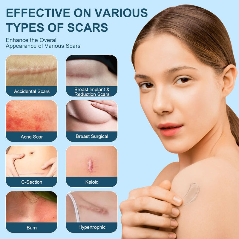 [Australia] - Advanced Scar Gel, Silicone Scar Gel, Treats Old and New Scars, Reduces the Appearance of Scars from, Body, Face, Stretch Marks, Surgical Scar, Keloids, Acne, Burns and More, 50g (1.76 Oz) 