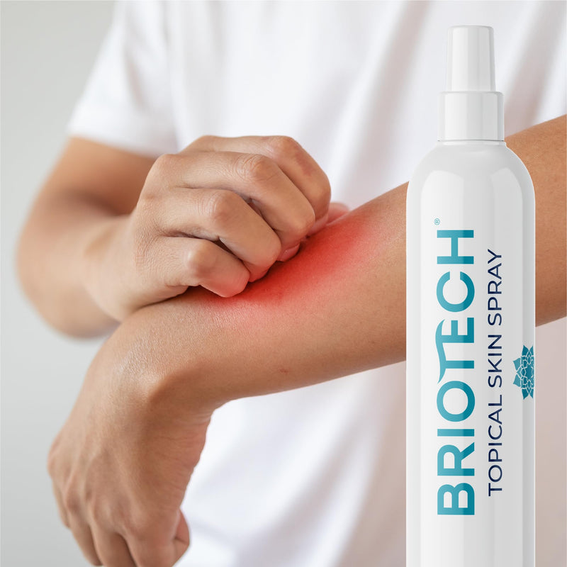 [Australia] - BRIOTECH Topical Skin Spray, Hypochlorous Acid Spray for Body & Face, Eyelid Cleanser, HOCl Facial Mist, Support Against Irritation, Calm Redness, Soothe Foot & Scalp, Packaging May Vary, 3.4 oz, 1 ct 3.4 Fl Oz (Pack of 1) 
