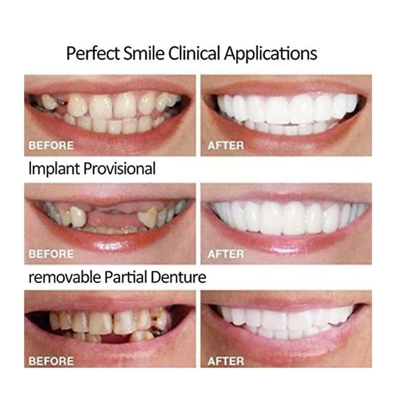[Australia] - 2 Pairs, Temporary Nature and Comfortable to Regain Confident Smile, Men's and Women's Temporary Confident Smile (1) 1 