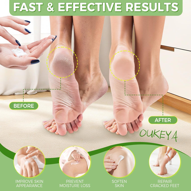 OUKEYA 40% Urea Foot Cream Salicylic Acid Tea Tree Oil Cracked Dry Skin | Ceramides Nourish Feet Hands Elbows Knees 150G 5.29 Ounce (Pack of 1)