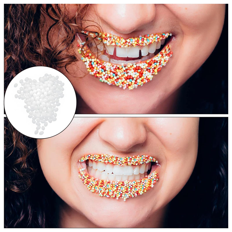 [Australia] - SNONESIY 100 g clip-on teeth, clip-on dentures, DIY dentures, used to repair missing teeth and denture veneers, temporary tooth repair beads 