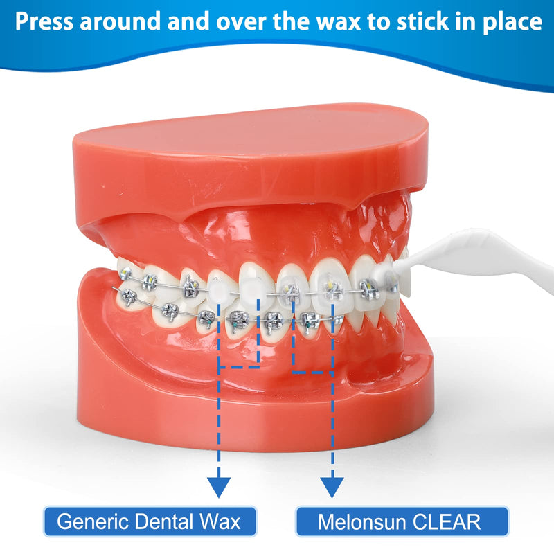 [Australia] - Braces Wax Precut, 10 Pack 50 Strips 350+ Perfect Size Dots,Includes Separate Cases,Big Storage Box & 2 Removal Tools, Food-Grade Premium Dental Wax- Stick Better(Unscented/Mint+Aloe Vera+Vitamin E) 