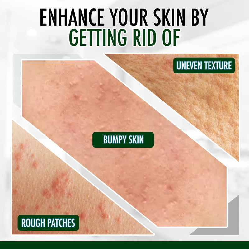 [Australia] - GLY MIRACLE Moisturizing Body Cream Lotion, 16 ounce - Non-Greasy Skin Humectant for Extremely Dry Skin, Hands, Body, and Feet, Fragrance-Free with Pure Glycerin for Nourishing Hydration. Unscented 16 Fl Oz (Pack of 1) 