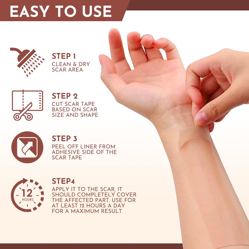 [Australia] - Silicone Scar Sheets - Silicone Scar Tape (1.6"x 120" Roll-3M) - keloid bump removal - Reusable And Effective Scar Removal Strips - Silicone Tape for Scars, Keloid, C-Section, Acne et 