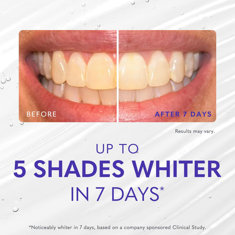 [Australia] - Smileactives Teeth Whitening Kit, Complete at Home Teeth Whitening Treatment, Travel Size Tooth Whitening, Stain Remover for White Teeth, Contains Clinical-Grade Hydrogen Peroxide, 30 Day Kit 0.5 Fl Oz (Pack of 2) 