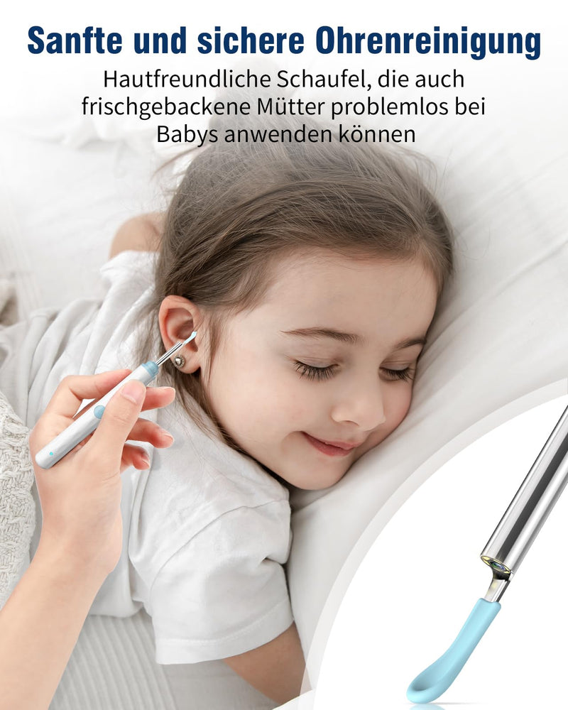 [Australia] - Kekoy Earwax Remover Otoscope with Light, 1296P Ear Cleaner with Camera, WiFi Ear Cleaner with Camera, Rechargeable Ear Cleaner, Ear Cleaner for Adults and Children (White Blue) White Blue 