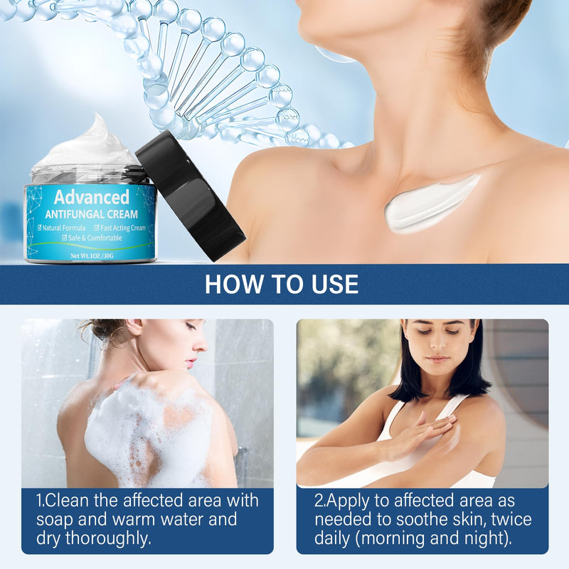 [Australia] - Skin fungus cream, athlete's foot cream with tea tree oil and herbal extracts, Expertcare fungicide for the treatment of athlete's foot and psoriasis - against itching, soothes, inflamed & dry skin 30 ml 