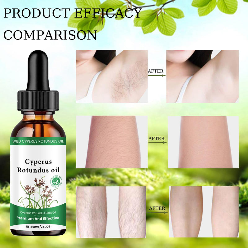 [Australia] - Cyperus Rotundus Oil, Cyperus Cyperus Hair Removal Oil, for Hair Removal, for Reducing and Inhibiting Body Hair Growth, for Smoothing the Skin, for Moisturizing and Soothing (Pack of 2) 
