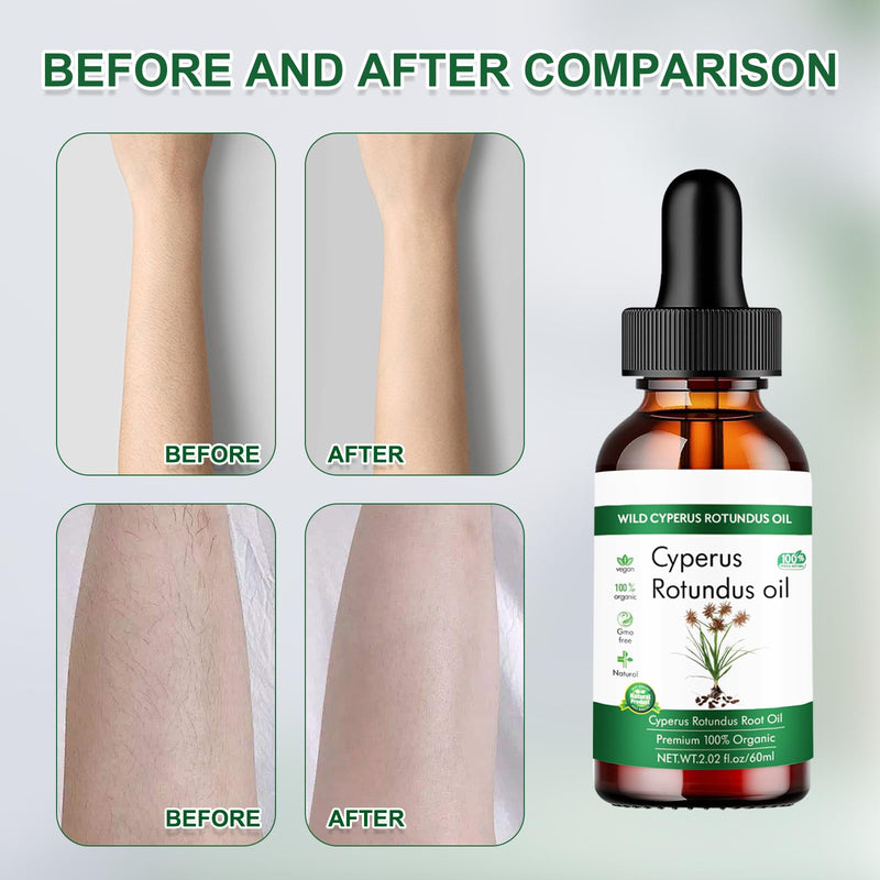 [Australia] - Cyperus Rotundus Cyperus Rotundus Oil Cyperus Oil Cyperus Rotundus oil Cyperus Rotundus Cyperus Rotundus Oil Cyperus Oil Cyperus Rotundus oil Cyperus Rotundus Cyperus Rotundus Oil Cyperus Oil 