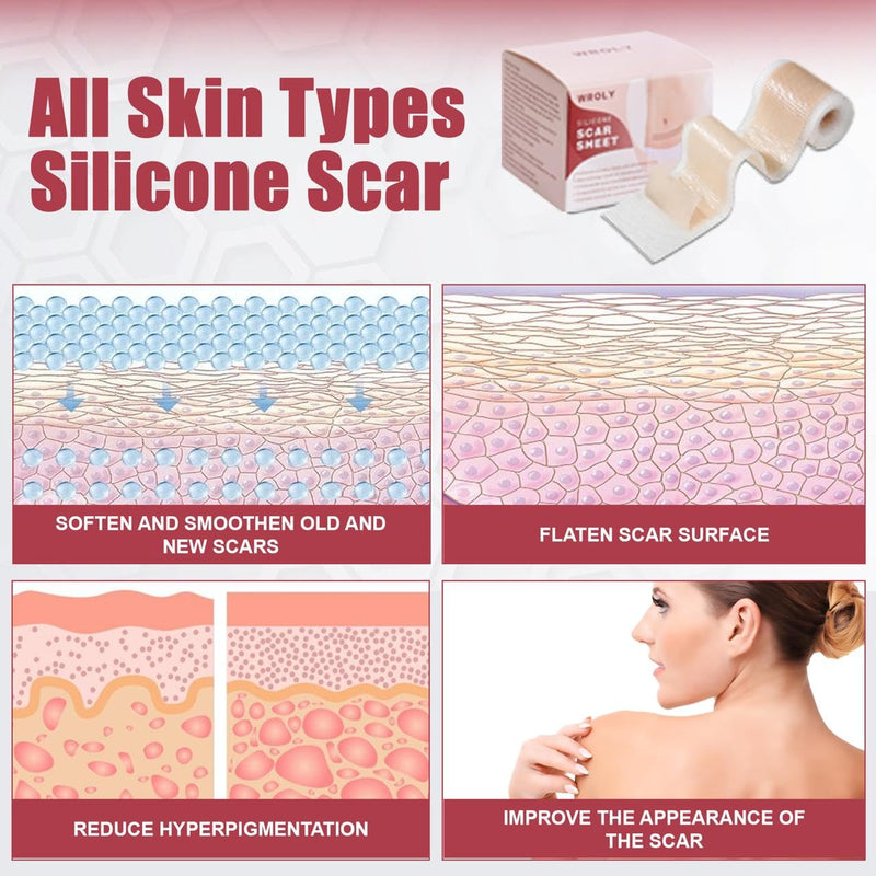 [Australia] - WROLY Silicone Scar Sheets, Keloid Scars Tape, Silicone Scar Tape for Surgical Scars, Keloid Bump Removal, C-Section Silicone Scar Removal Strips for Surgical, Tummy Tuck (1.5M) 1.5M 